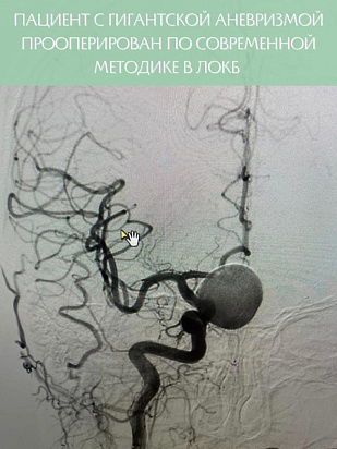 В Ленинградской областной клинической больнице прооперировали пациента с гигантской аневризмой по современной методике